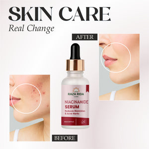 Niacinamide Serum