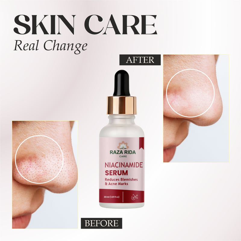 Raza Rida Care Niacinamide Serum before after results