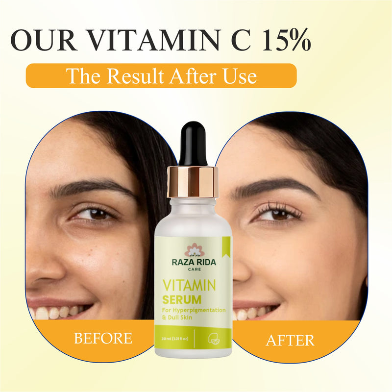 Raza Rida Care Vitamin C Serum before after results